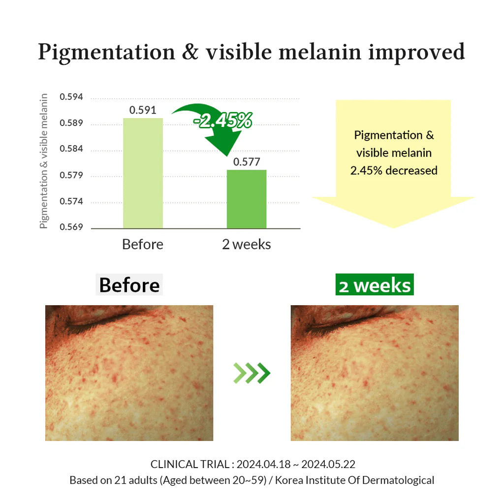 Gentle Vitamin C Serum Dr Althea, 30 ml