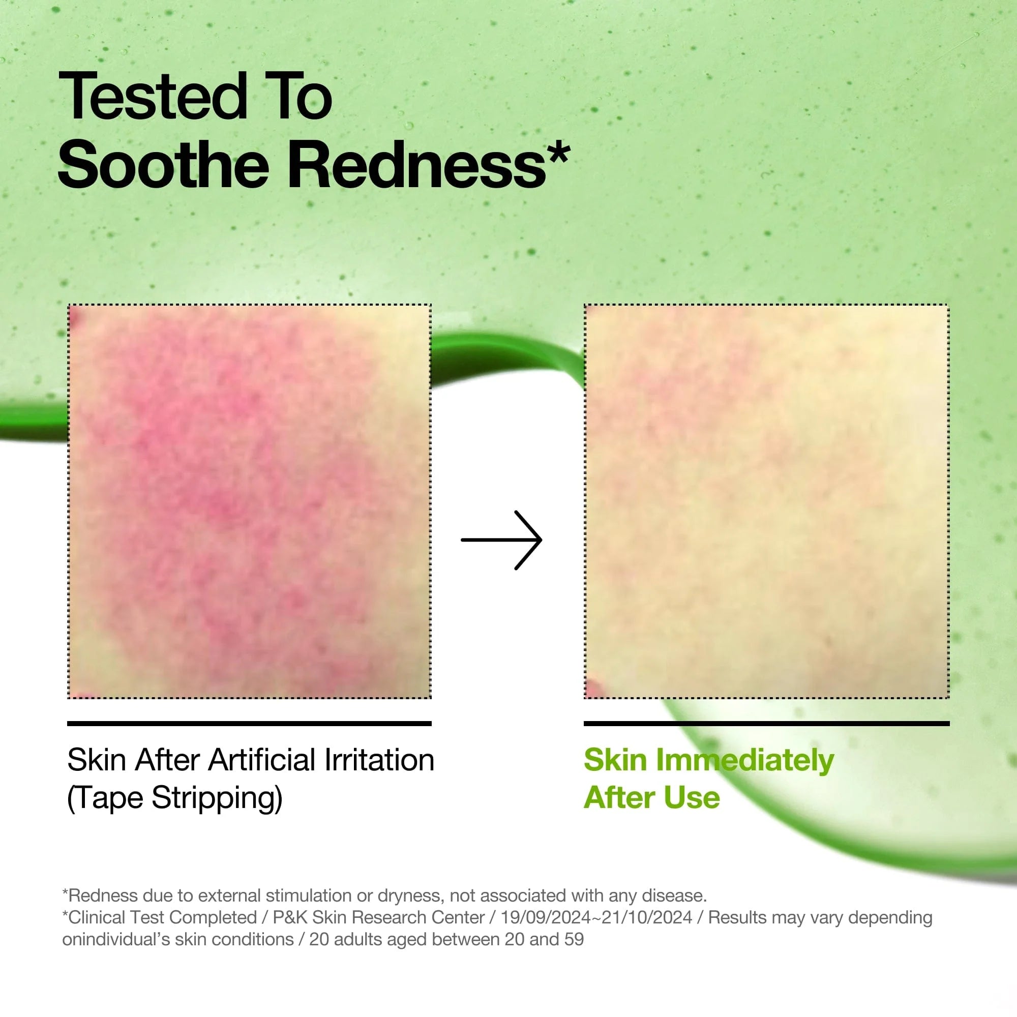 Azelaic Acid 10 Hyaluron Redness Soothing Serum ANUA, 30 ml